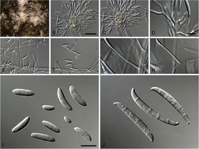 Neocosmospora rubicola, a stem rot disease in potato: Characterization, distribution and management